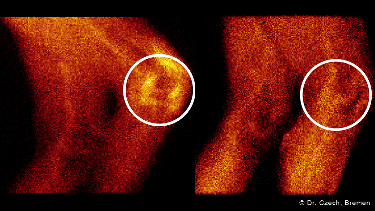 Logo der CME Fortbildung "Radiosynoviorthese - Bewährtes und Bekanntes"