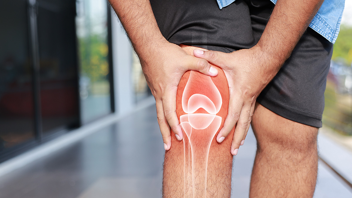 Teaserbild zum CME: Kniearthrose -  Was die Leitlinie empfiehlt