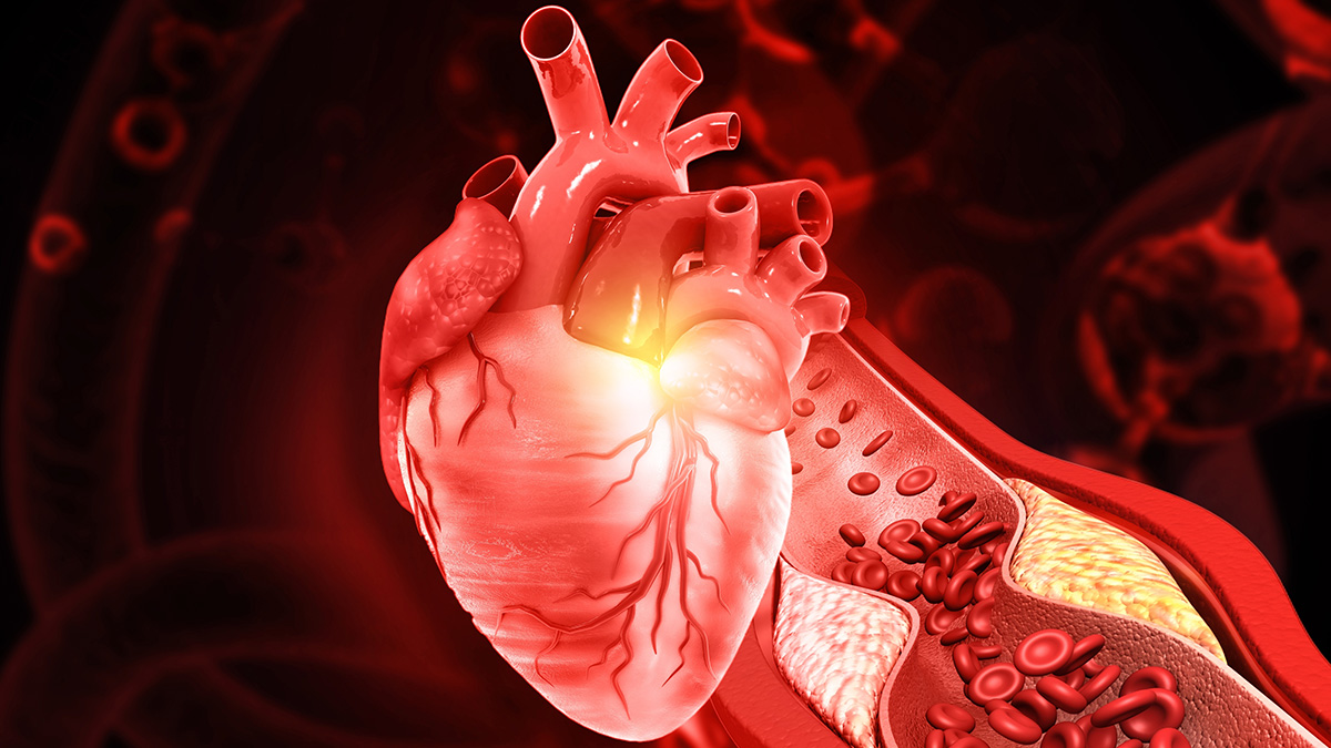 Logo der CME Fortbildung "Lipoprotein(a) - Bedeutung für die kardiovaskuläre Risikobewertung "