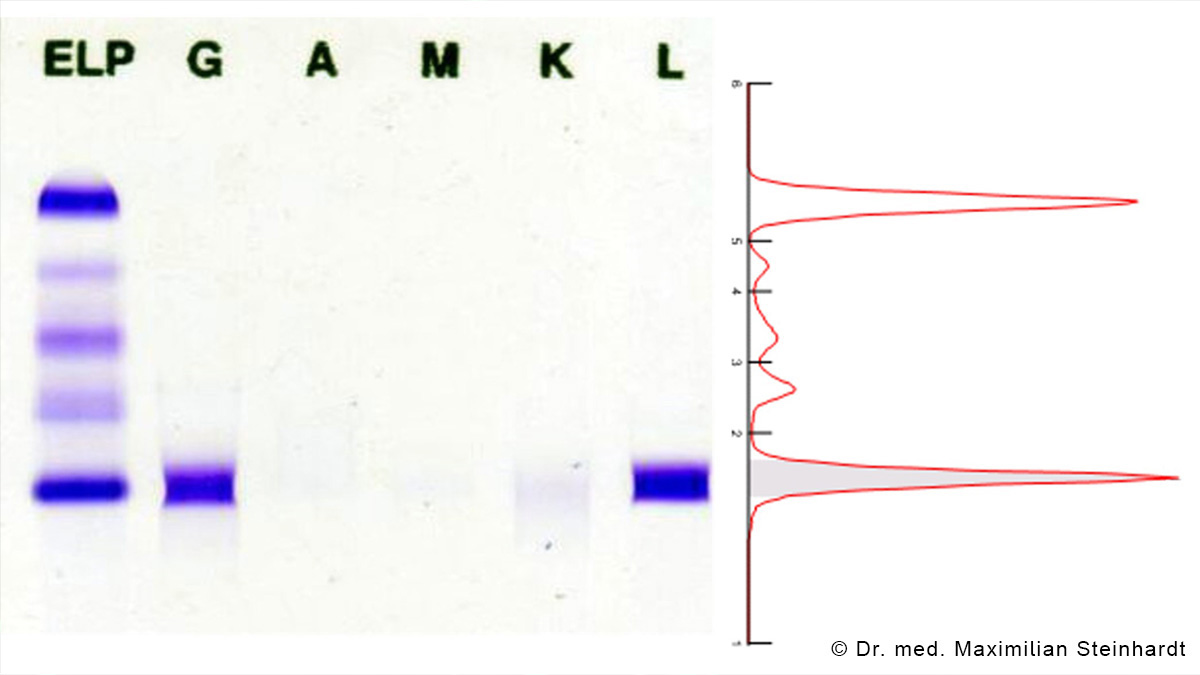 Logo der CME Fortbildung "Risiko-adaptierte Diagnostik bei monoklonalen Gammopathien – MGUS, Amyloidose, Myelom "