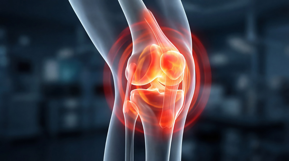 Logo der CME Fortbildung "Impfen bei rheumatologischen Erkrankungen"
