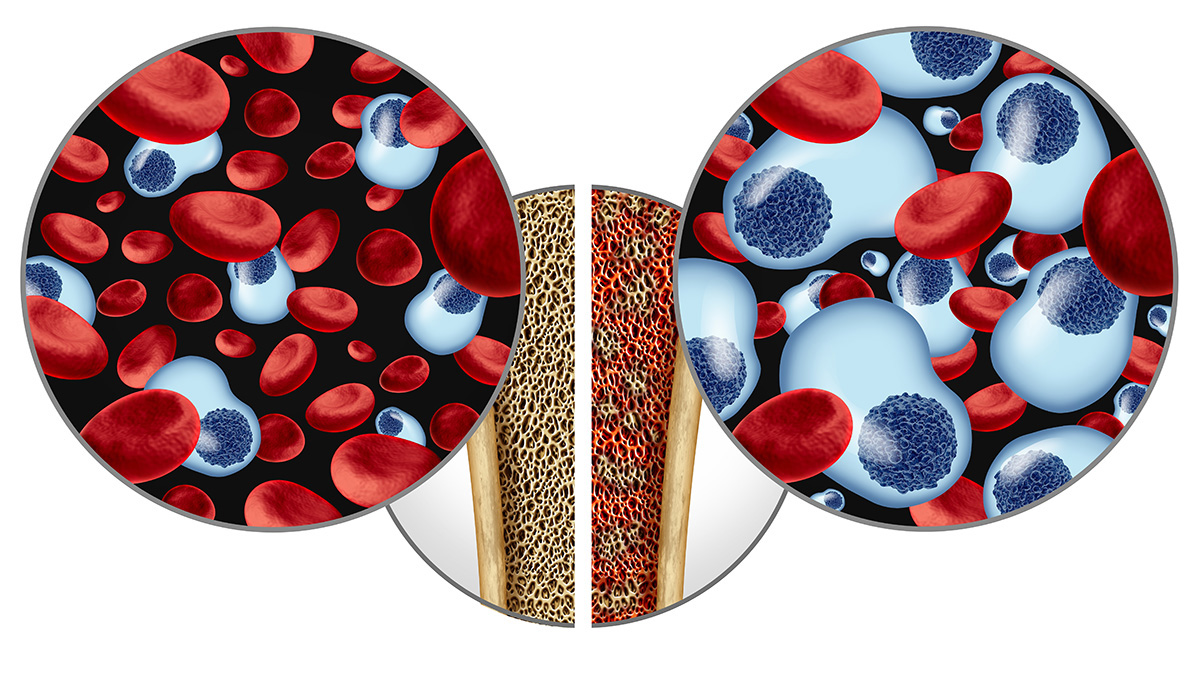 Logo der CME Fortbildung "Multiples Myelom - Therapieoptionen in der 2. Therapielinie & Patientenfall aus der Praxis"