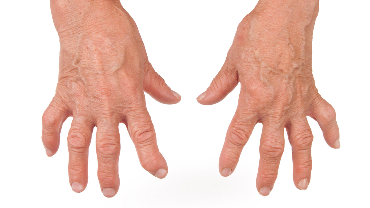 Logo der CME Fortbildung "Diagnose und Therapie bei Gelenkbeschwerden durch Arthrose/Arthritis"